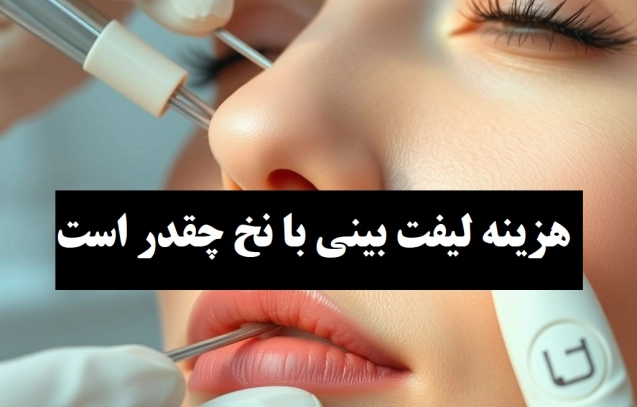 هزینه لیفت بینی با نخ چقدر است