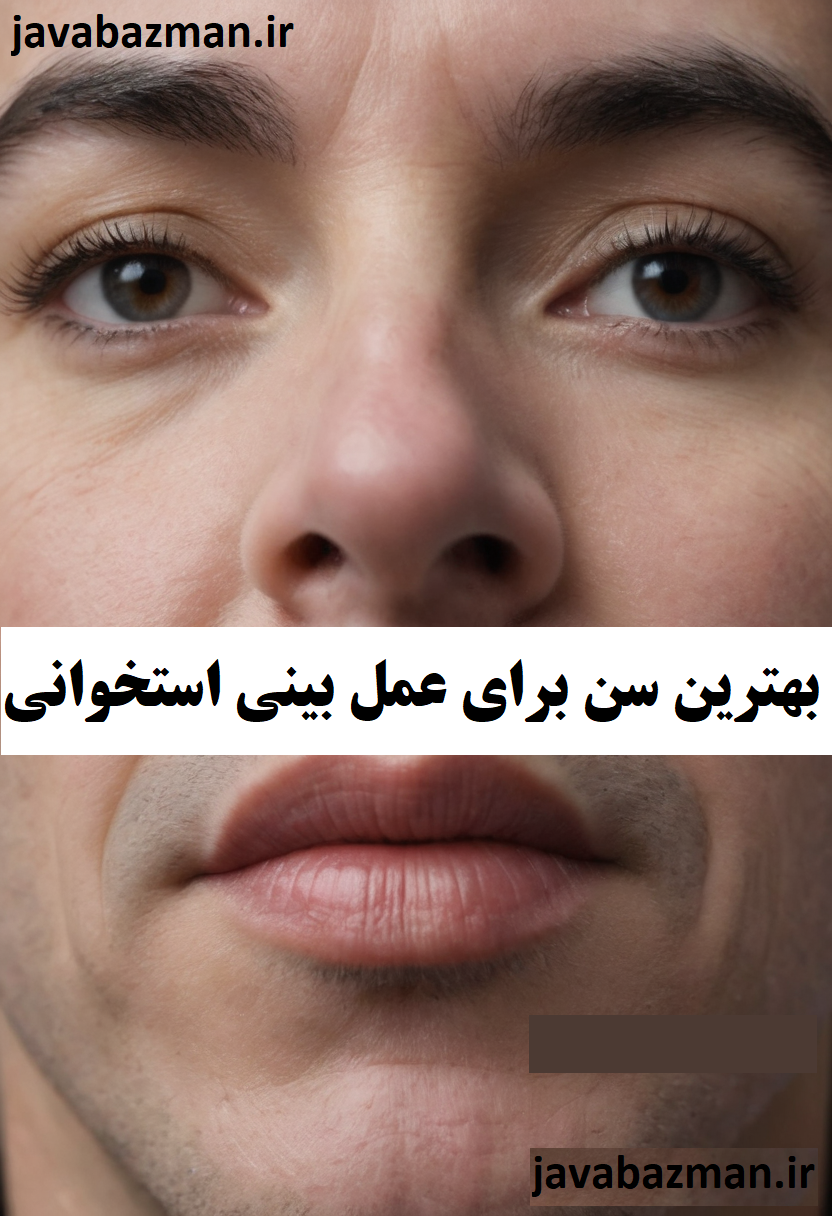 بهترین سن برای عمل بینی استخوانی