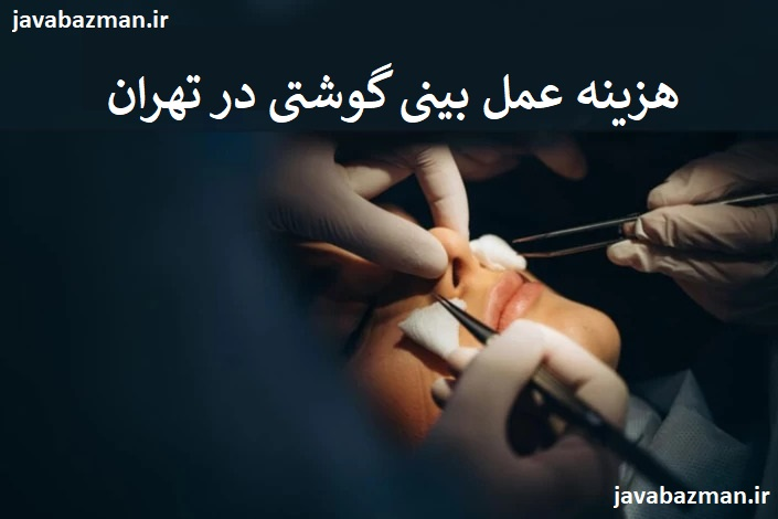 هزینه عمل بینی گوشتی در تهران