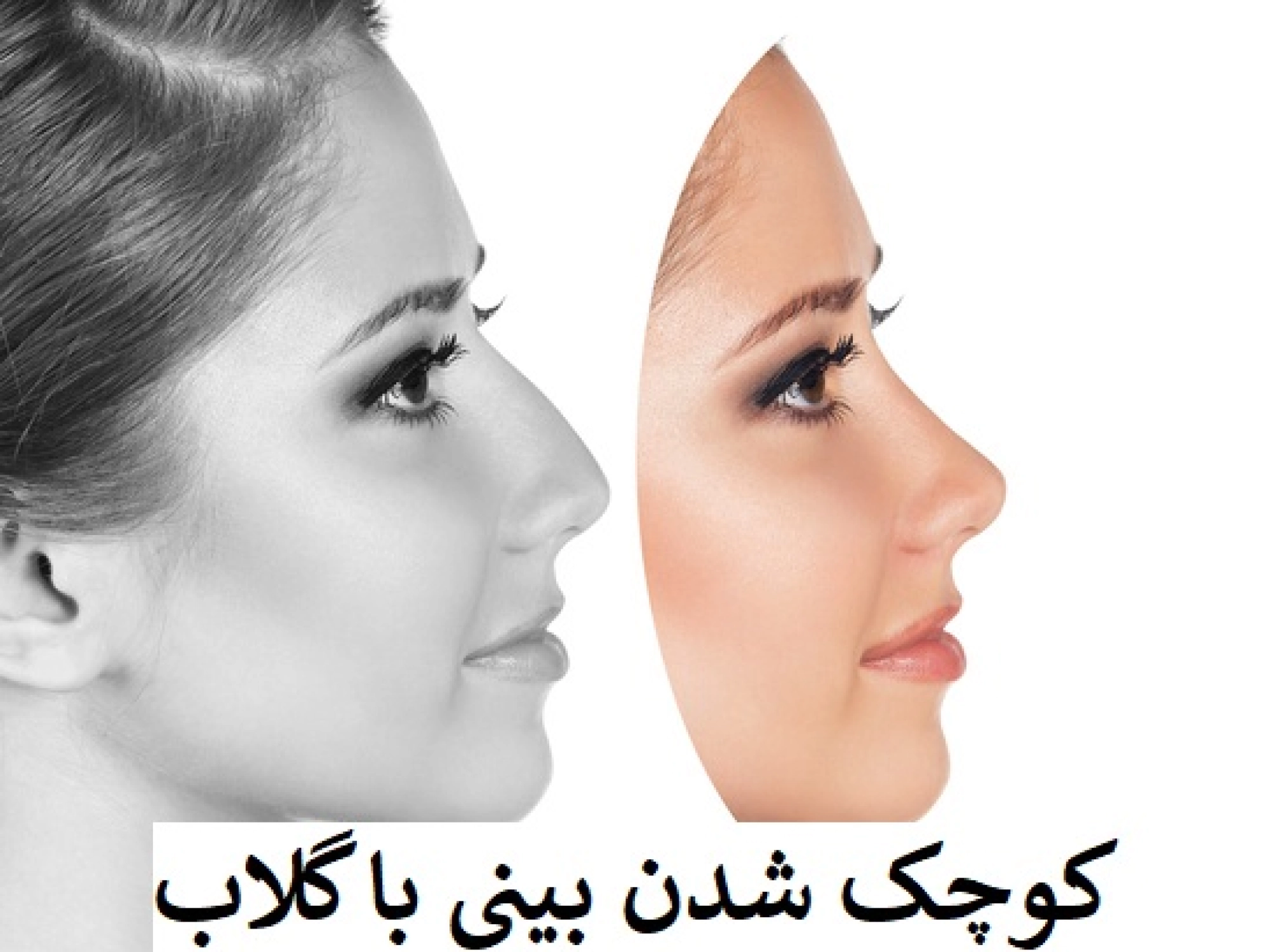 کوچک شدن بینی با گلاب