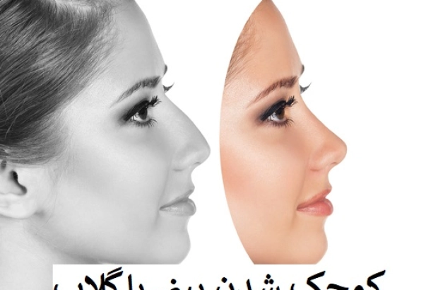 کوچک شدن بینی با گلاب
