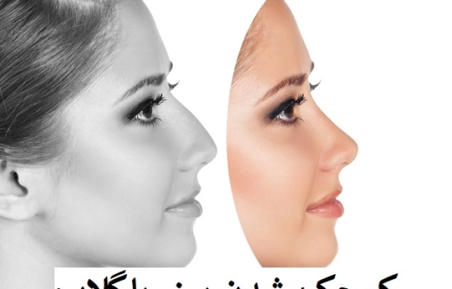 کوچک شدن بینی با گلاب