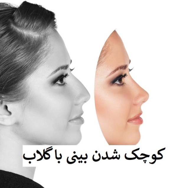 کوچک شدن بینی با گلاب