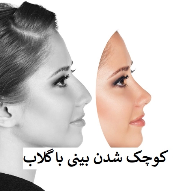 کوچک شدن بینی با گلاب