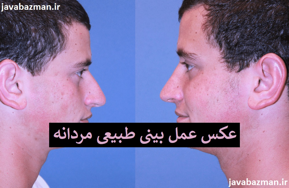 عکس عمل بینی طبیعی مردانه