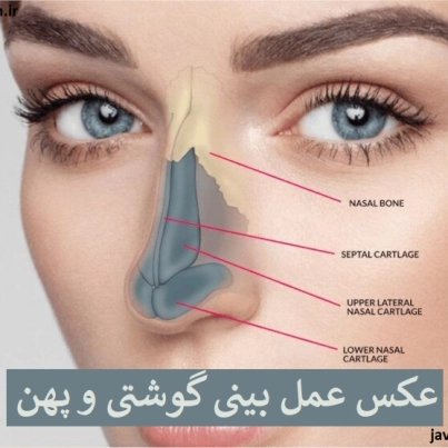 عکس عمل بینی گوشتی و پهن