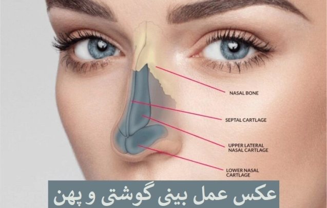عکس عمل بینی گوشتی و پهن