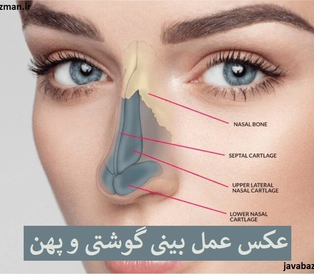 عکس عمل بینی گوشتی و پهن