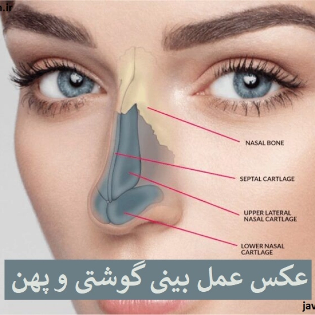 عکس عمل بینی گوشتی و پهن