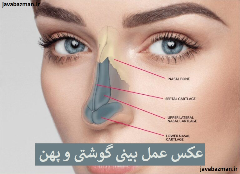 عکس عمل بینی گوشتی و پهن