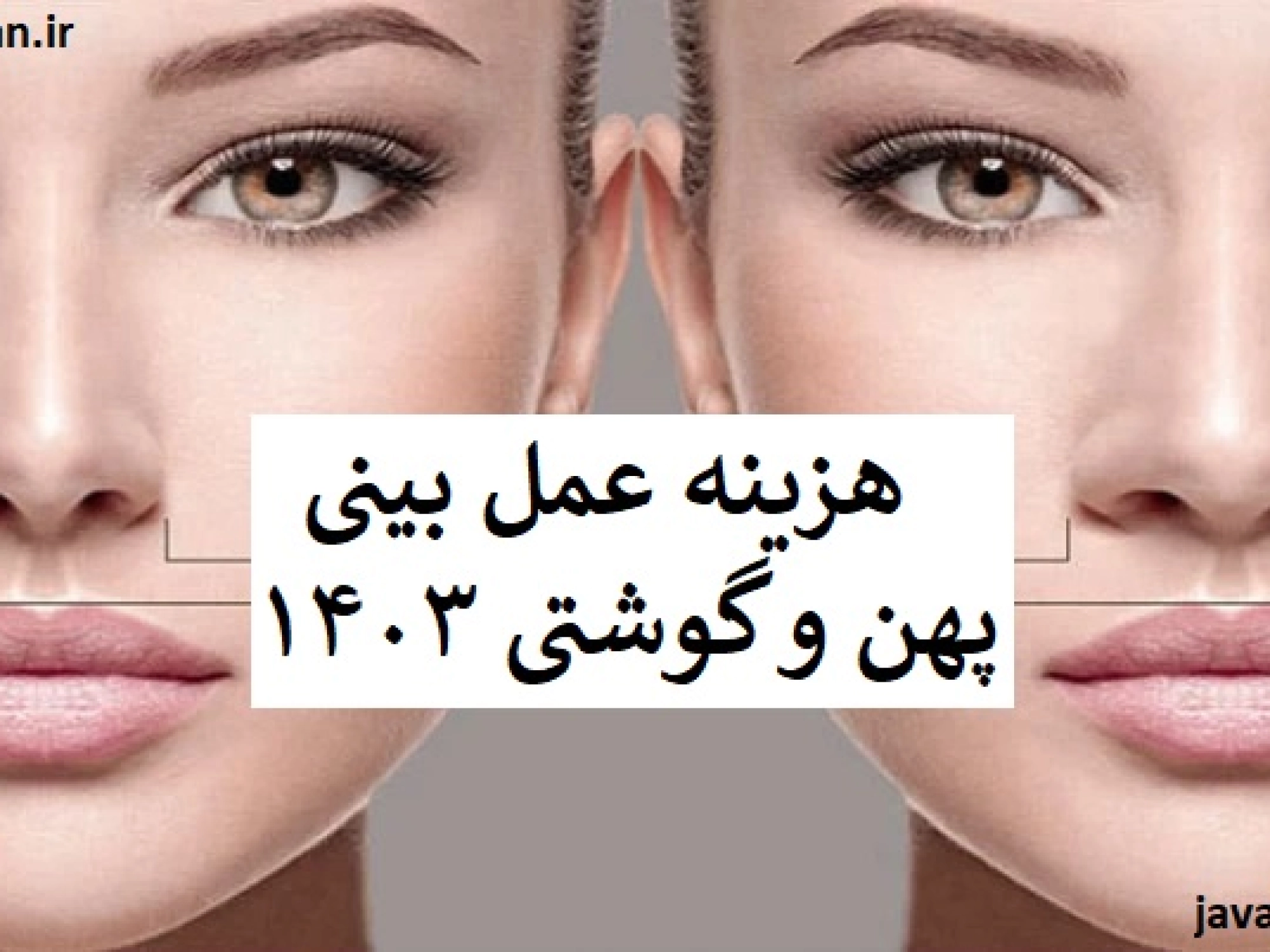 هزینه عمل بینی پهن و گوشتی ۱۴۰۳