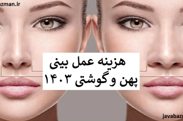 هزینه عمل بینی پهن و گوشتی ۱۴۰۳