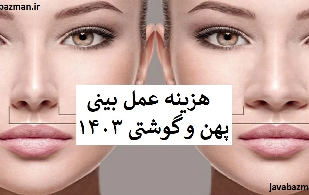هزینه عمل بینی پهن و گوشتی ۱۴۰۳