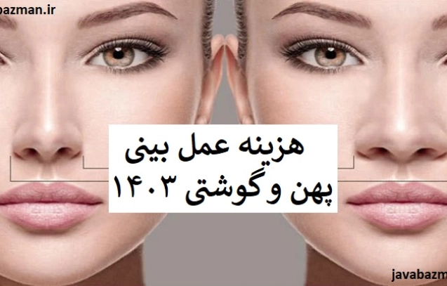 هزینه عمل بینی پهن و گوشتی ۱۴۰۳