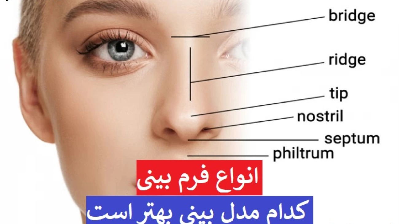 انواع بینی + انواع فرم بینی + کدام مدل بینی بهتر است + انواع بینی گوشتی