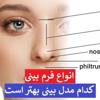 انواع بینی + انواع فرم بینی + کدام مدل بینی بهتر است + انواع بینی گوشتی