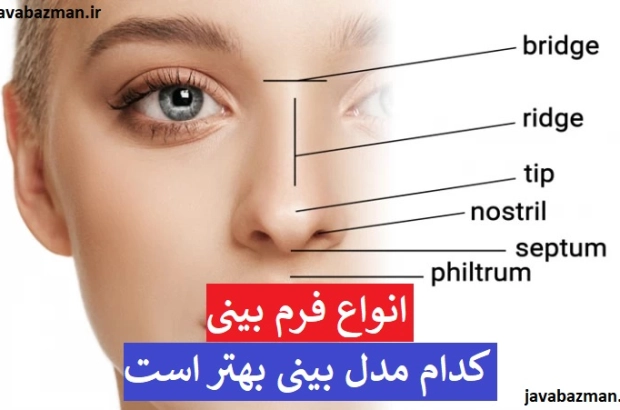 انواع بینی + انواع فرم بینی + کدام مدل بینی بهتر است + انواع بینی گوشتی