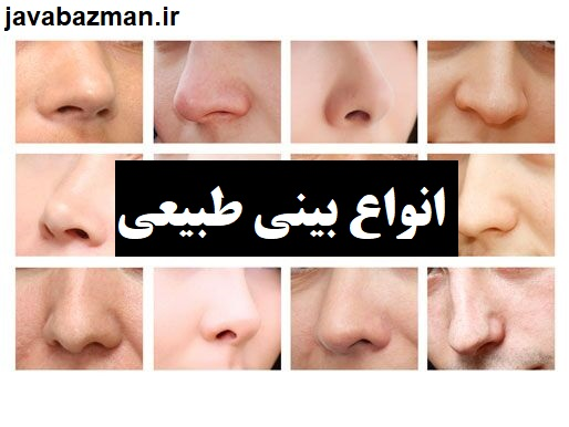 انواع بینی طبیعی