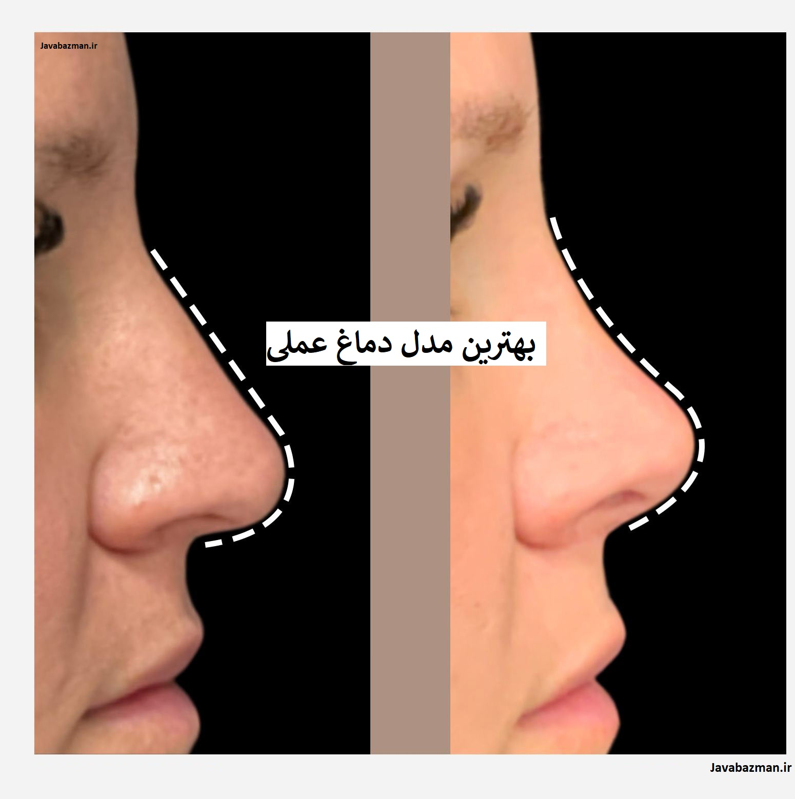 بهترین مدل دماغ عملی