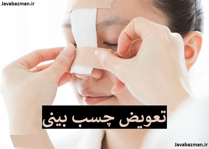 تعویض چسب بینی