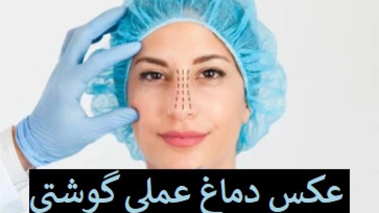 عکس دماغ عملی گوشتی