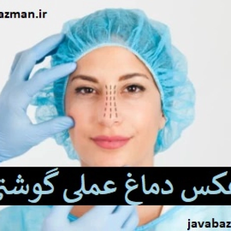 عکس دماغ عملی گوشتی