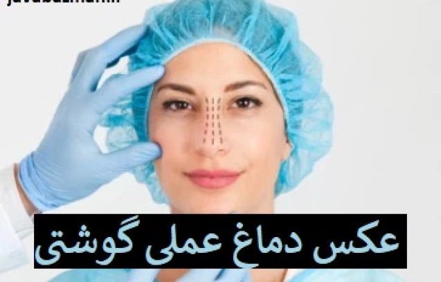 عکس دماغ عملی گوشتی