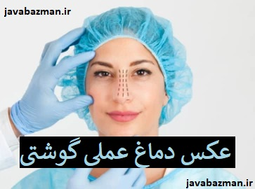 عکس دماغ عملی گوشتی