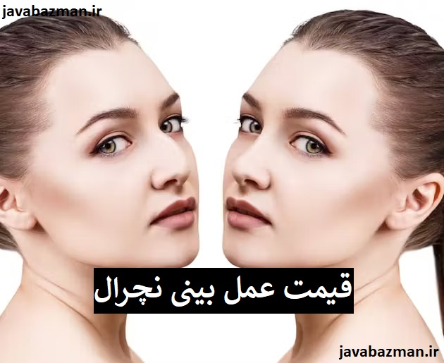 قیمت عمل بینی نچرال