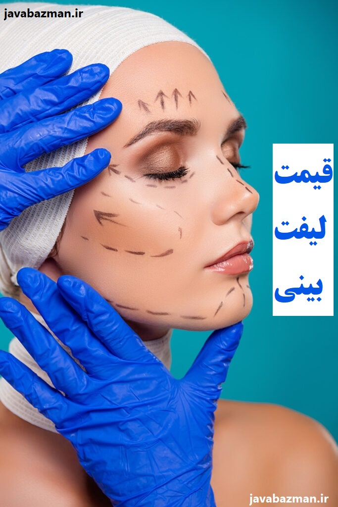 قیمت لیفت بینی