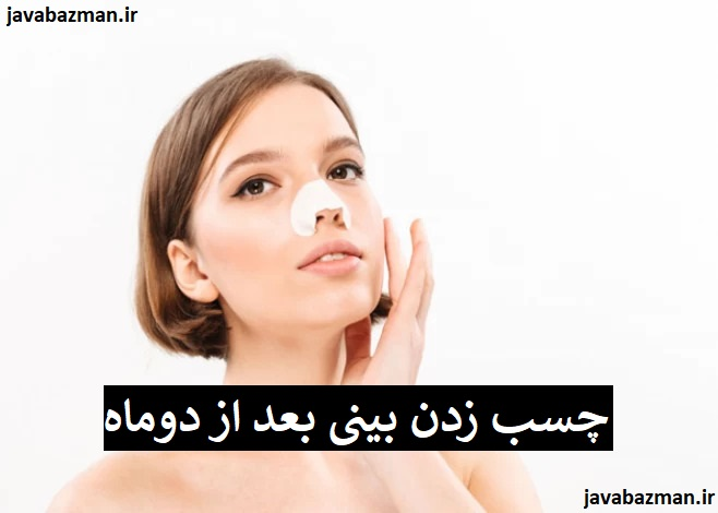 چسب زدن بینی بعد از دوماه