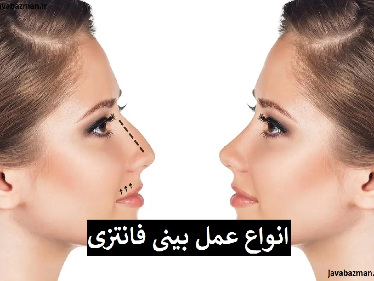 انواع عمل بینی فانتزی