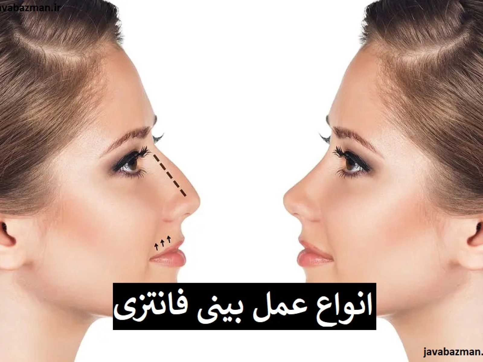 انواع عمل بینی فانتزی