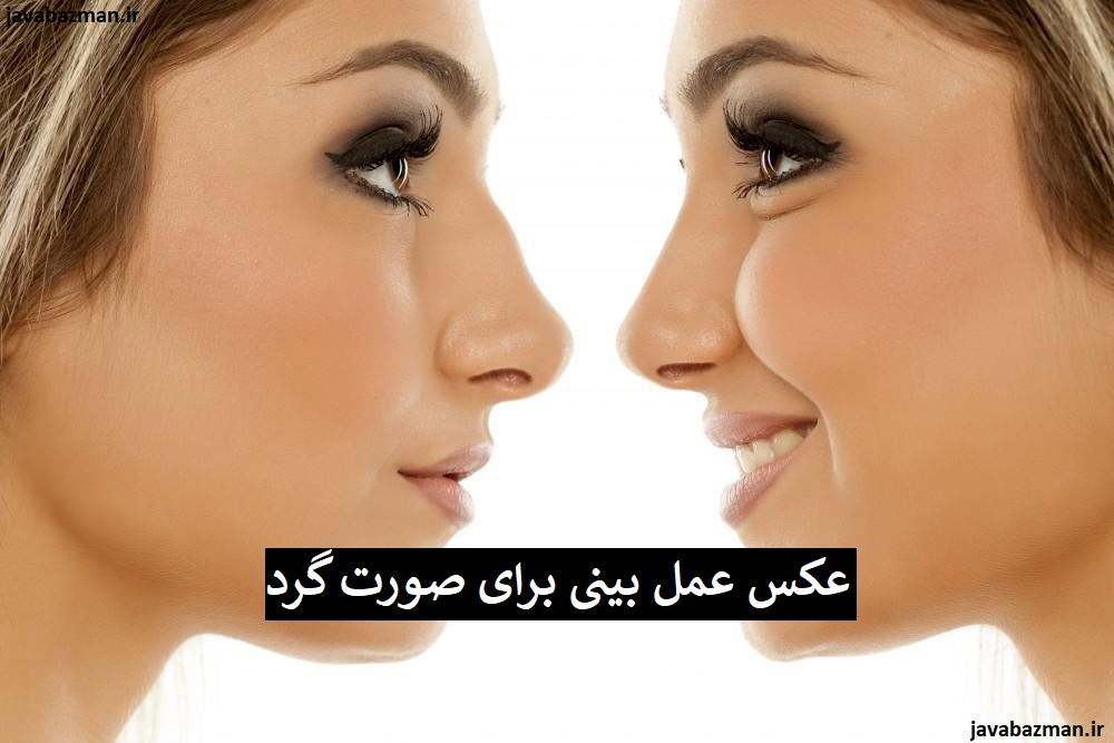 عکس عمل بینی برای صورت گرد