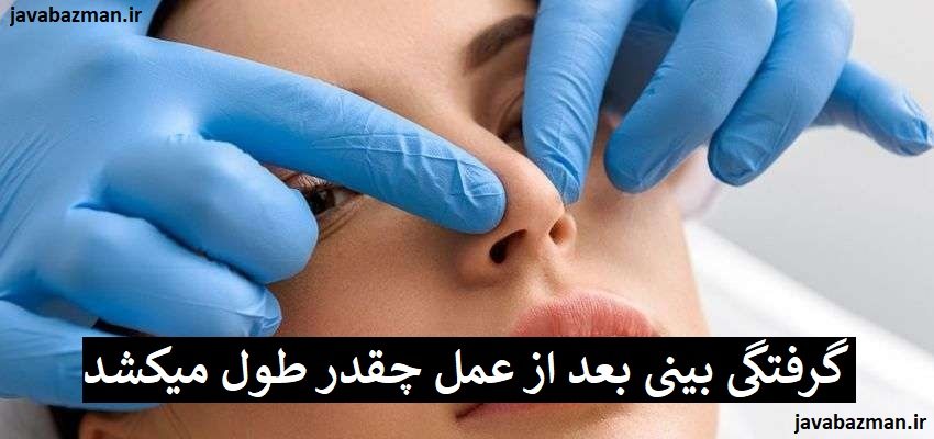 گرفتگی بینی بعد از عمل چقدر طول میکشد