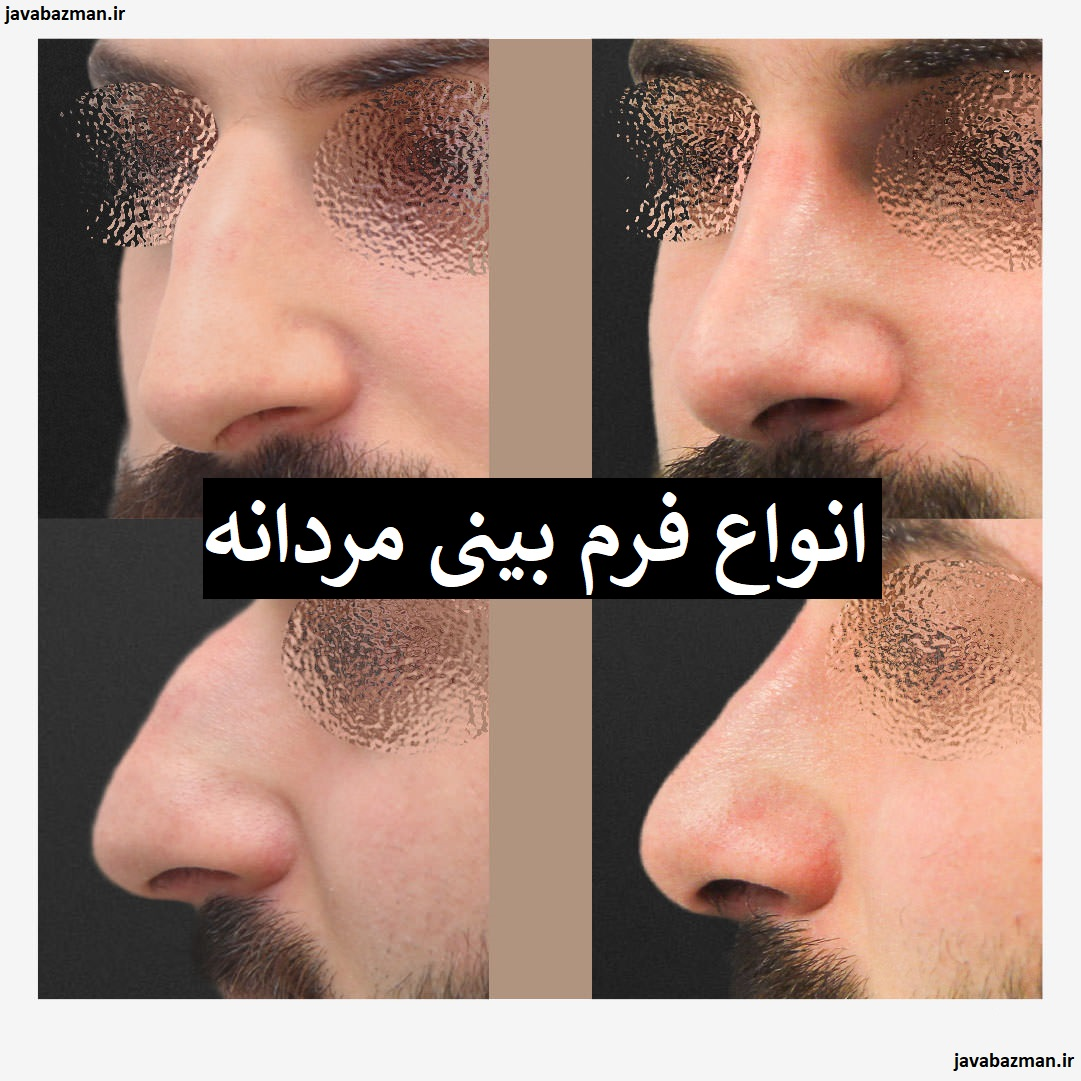 انواع فرم بینی مردانه