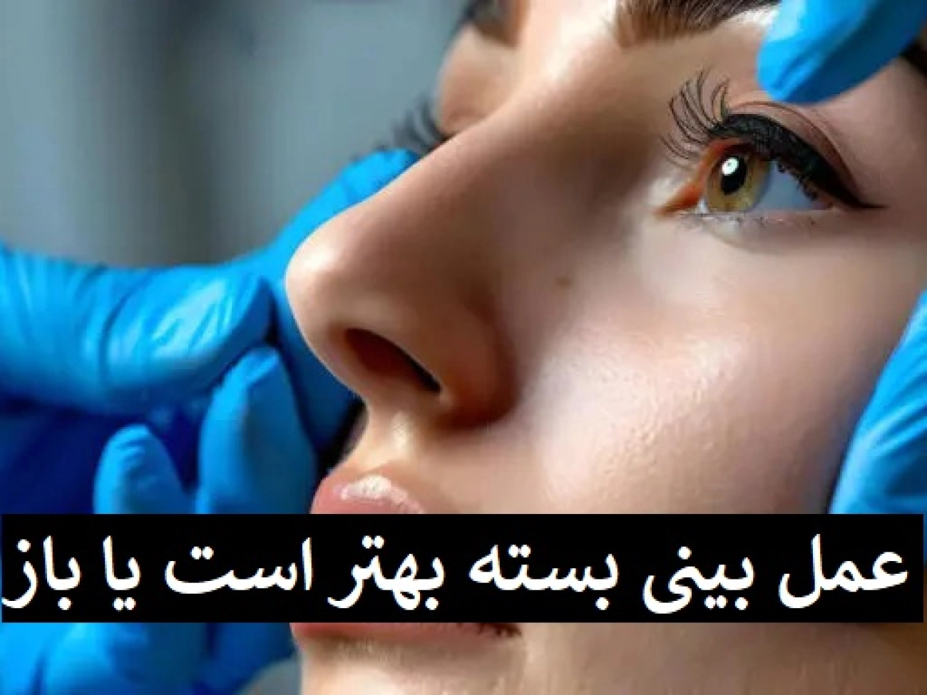 عمل بینی بسته بهتر است یا باز