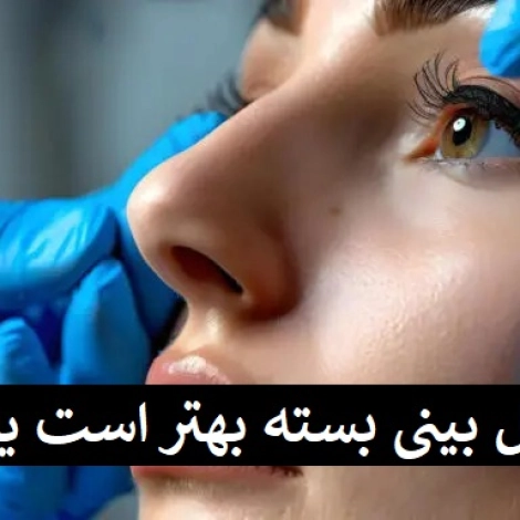 عمل بینی بسته بهتر است یا باز