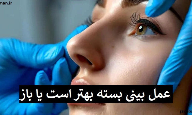 عمل بینی بسته بهتر است یا باز