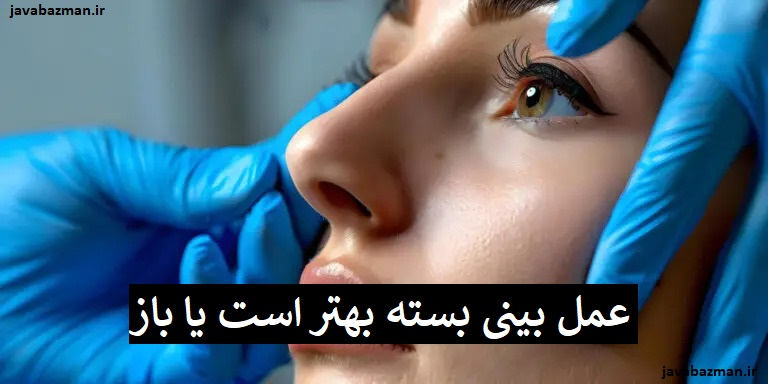 عمل بینی بسته بهتر است یا باز