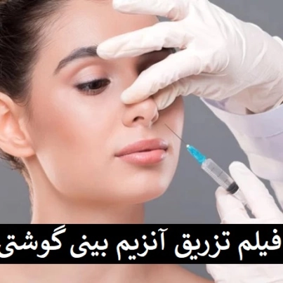 فیلم تزریق آنزیم بینی گوشتی