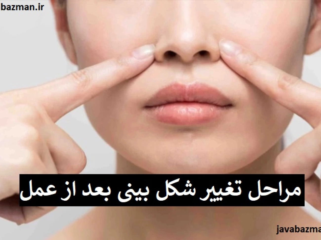 مراحل تغییر شکل بینی بعد از عمل