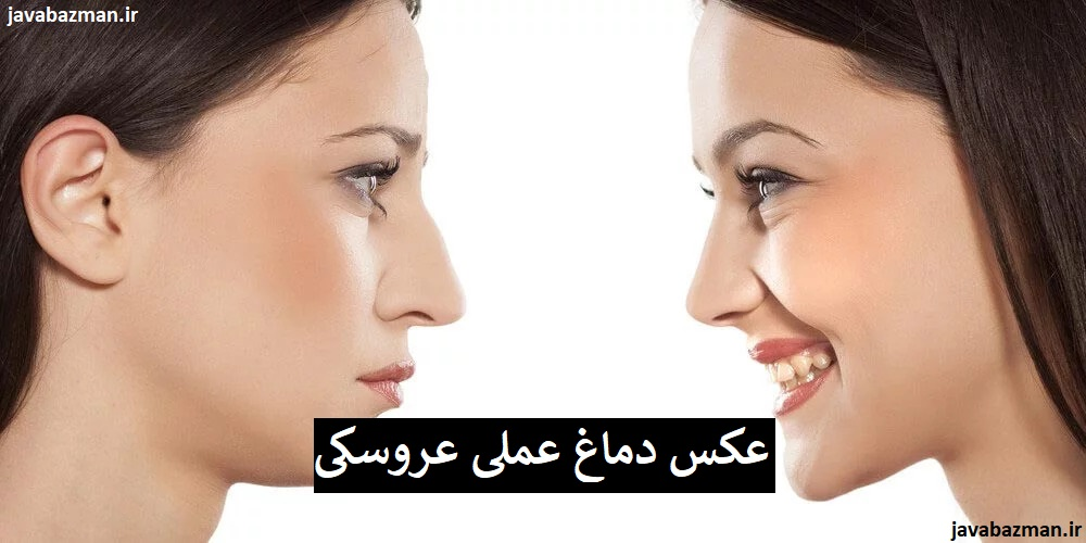 عکس دماغ عملی عروسکی
