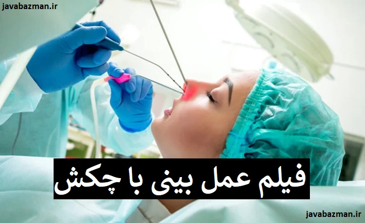 فیلم عمل بینی با چکش