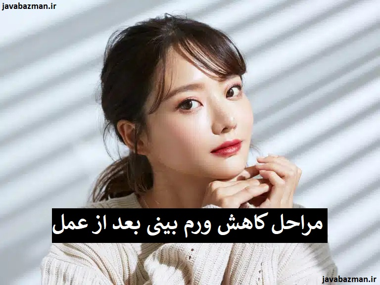 مراحل کاهش ورم بینی بعد از عمل