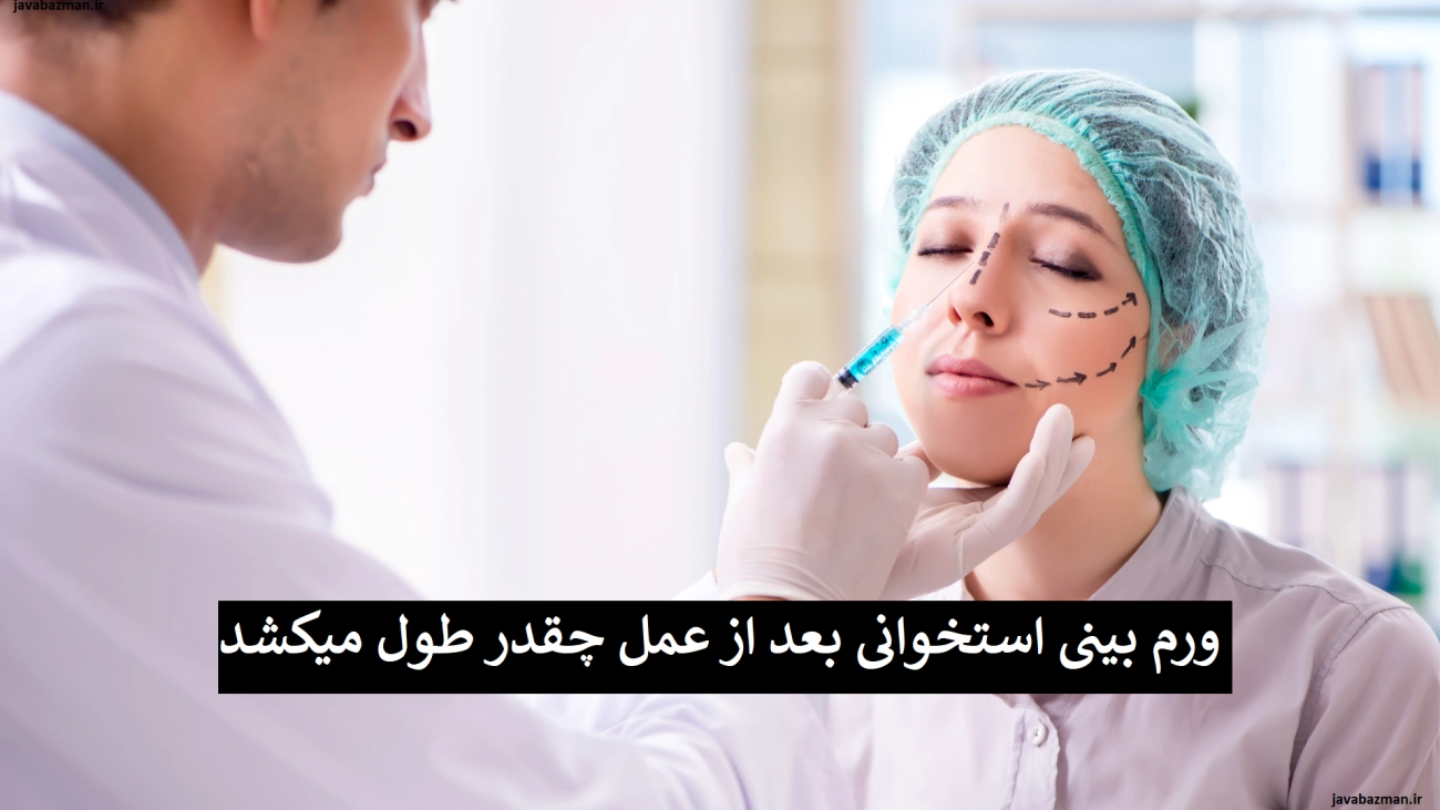 ورم بینی استخوانی بعد از عمل چقدر طول میکشد