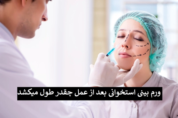 ورم بینی استخوانی بعد از عمل چقدر طول میکشد