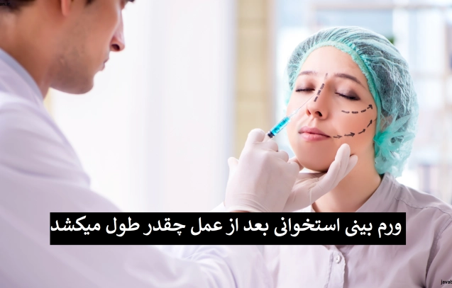 ورم بینی استخوانی بعد از عمل چقدر طول میکشد